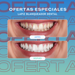 ™Lápiz blanqueador dental I DIENTES MAS BLANCOS